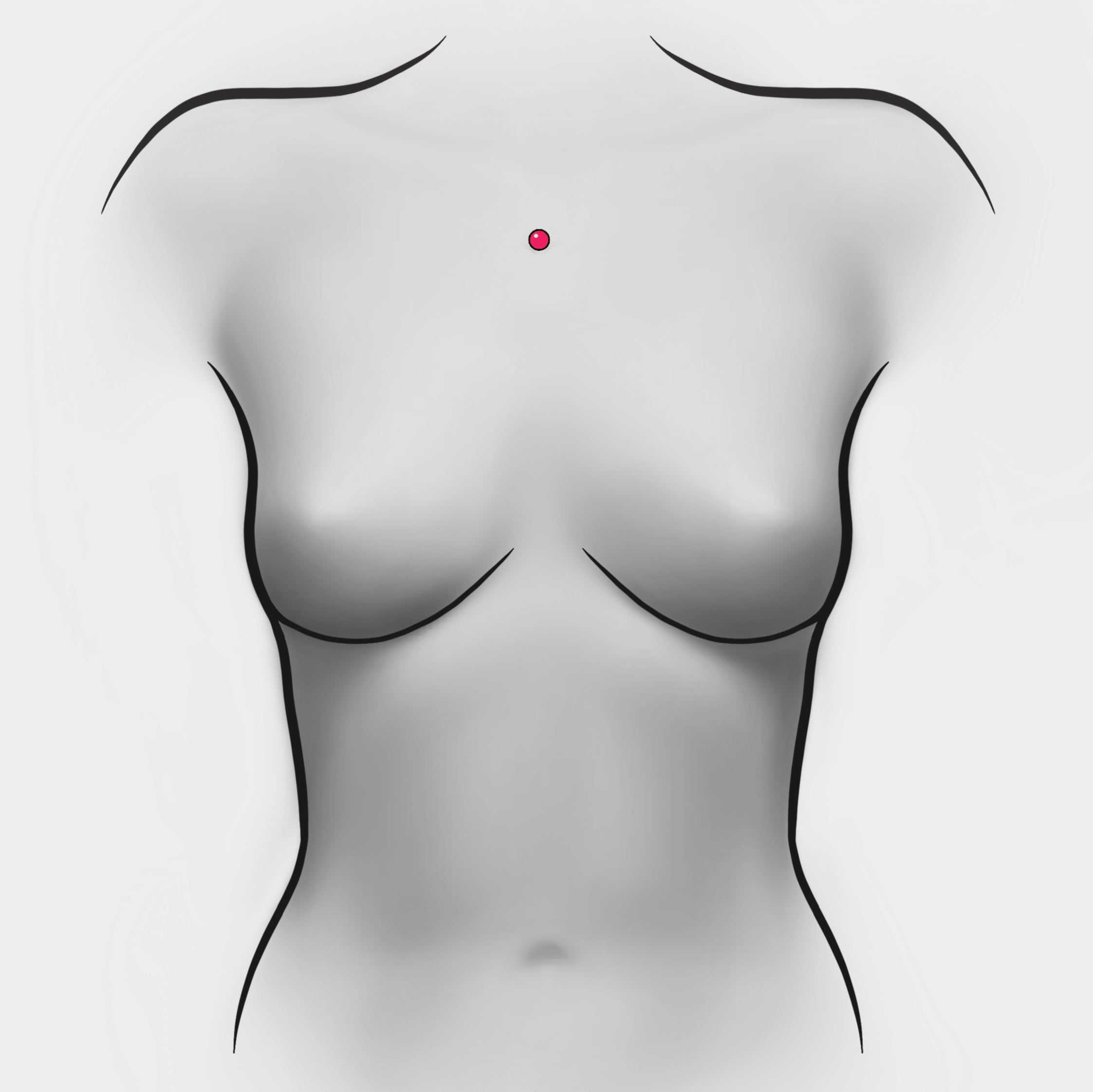 Piercing Dermal Removal