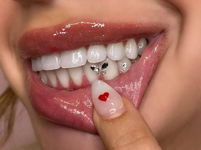 Luxury tooth gem application in Cork at Smiley Dogg Tattoo Studio